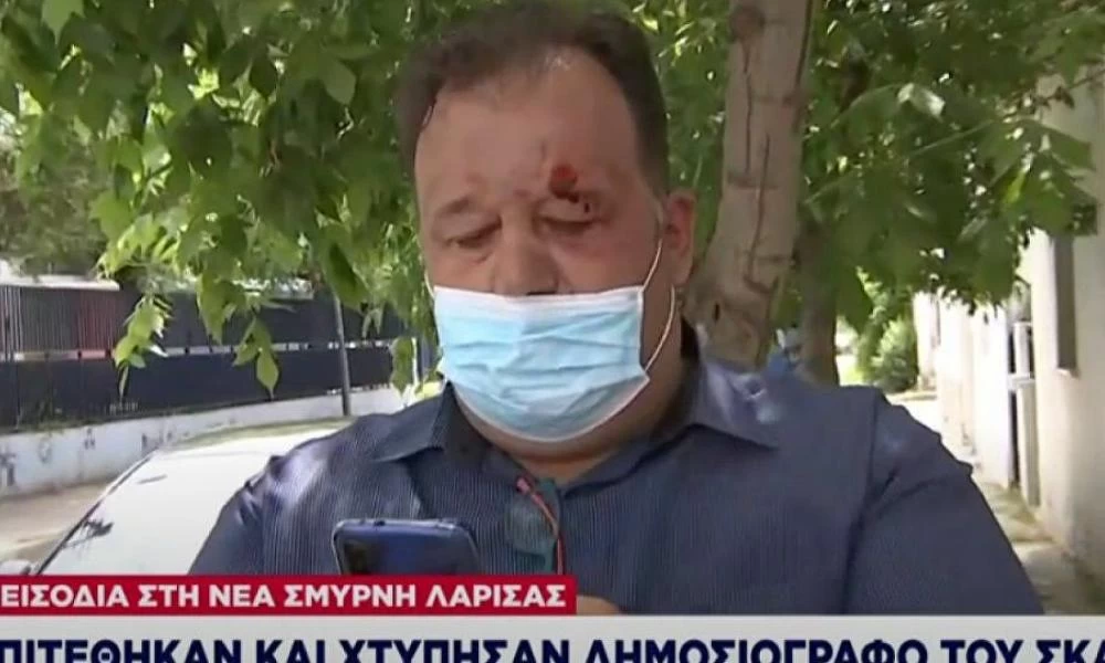 Λάρισα: Απρόκλητη επίθεση Ρομά σε δημοσιογράφο μπροστά σε αστυνομικούς
